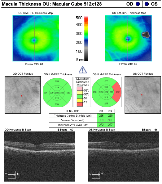 Macula Scan